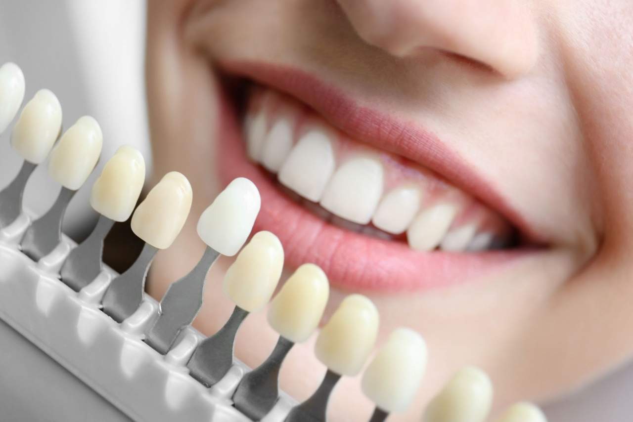 Clínica dental Helident en Sevilla: ¿Cuáles son las búsquedas acerca de los implantes dentales en Sevilla?