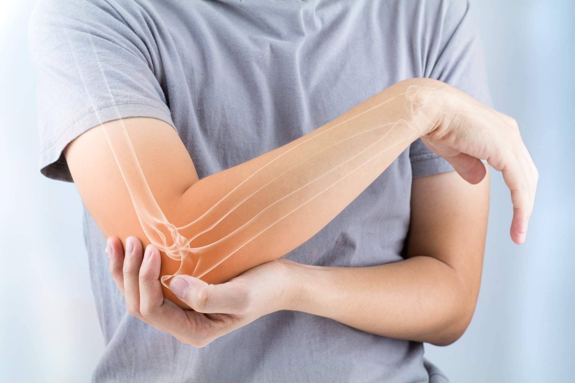 Los complementos naturales para mejorar la salud de las articulaciones y los huesos de Diet & Life