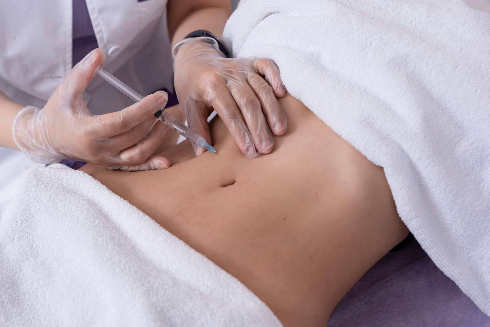 ¿Cuáles son los beneficios de realizarse la mesoterapia corporal?, de la mano de Alluring Clinic