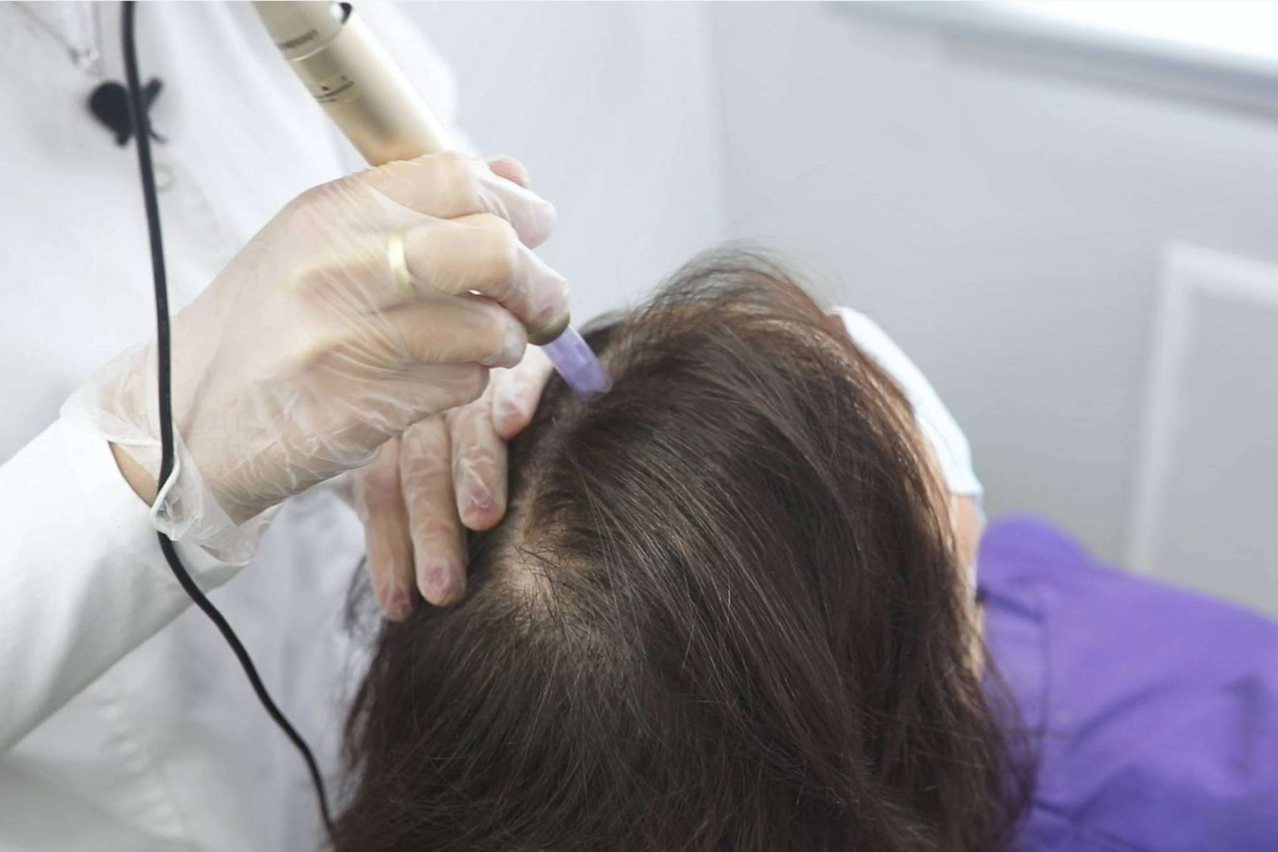 Recuperar el cabello con el efectivo tratamiento de bioestimulación para la alopecia femenina del IMD Instituto Médico Dermatológico