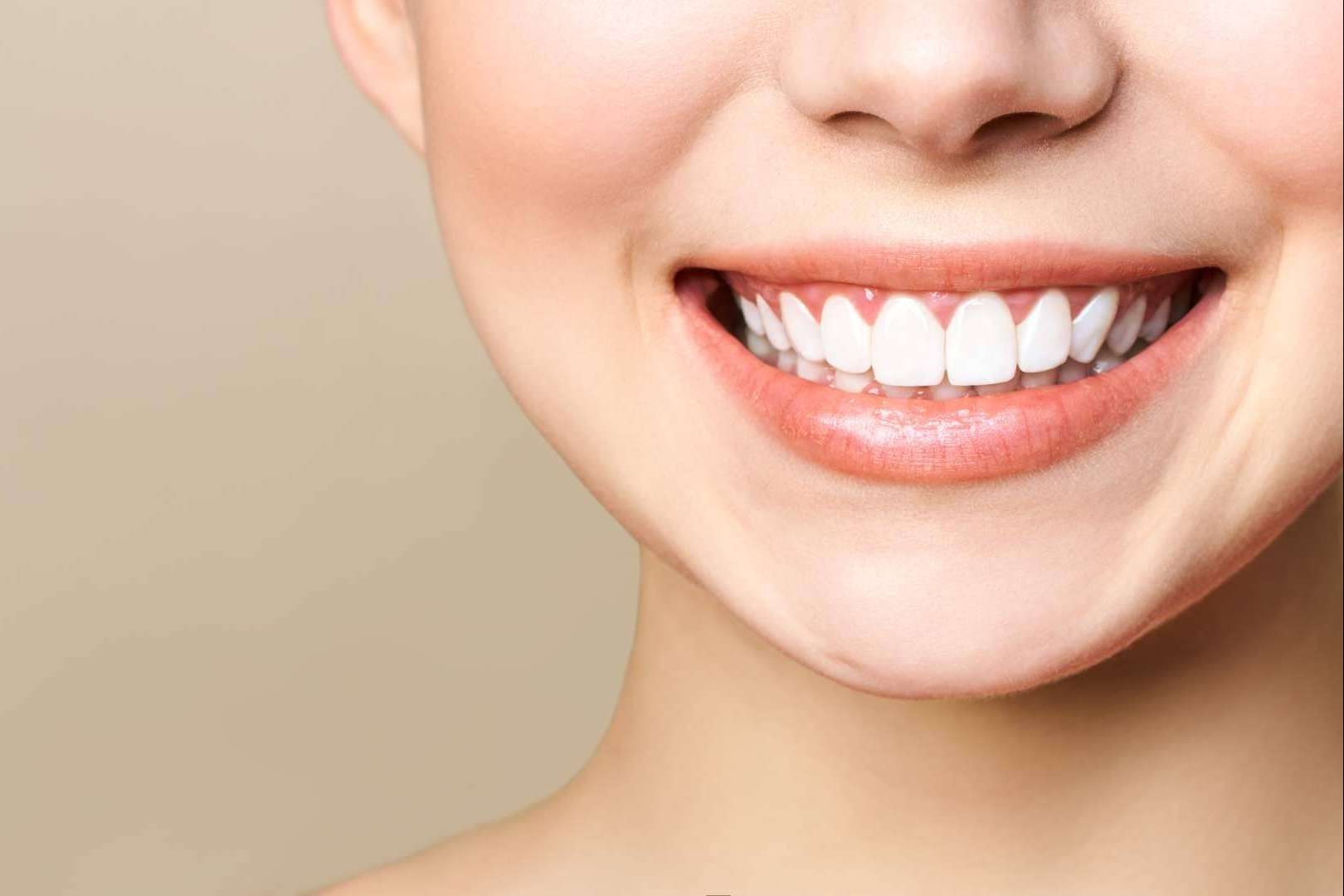 Carlos Saiz Smile explica qué son las carillas de composite